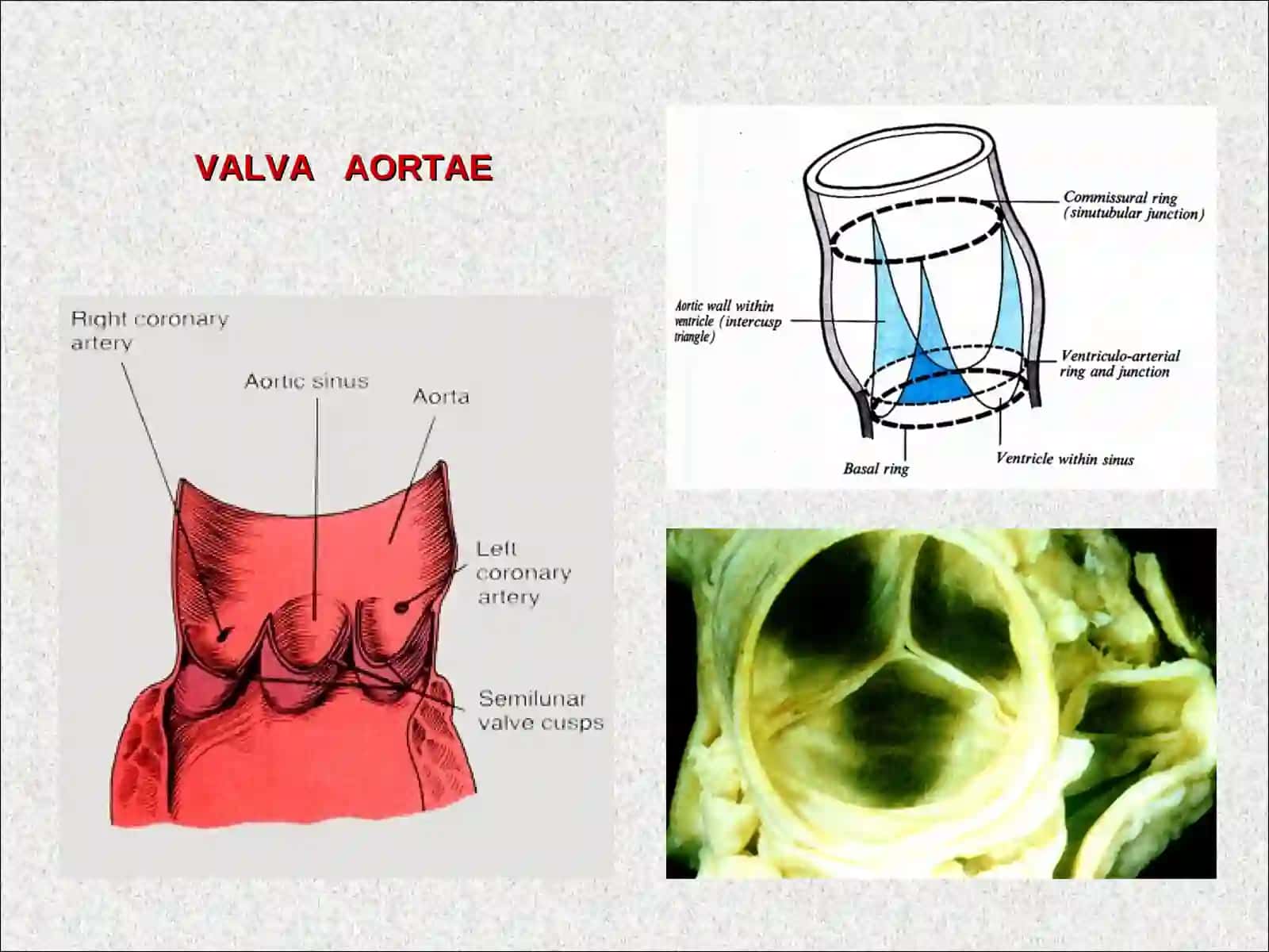 O’mrov osti arteriyasi 4