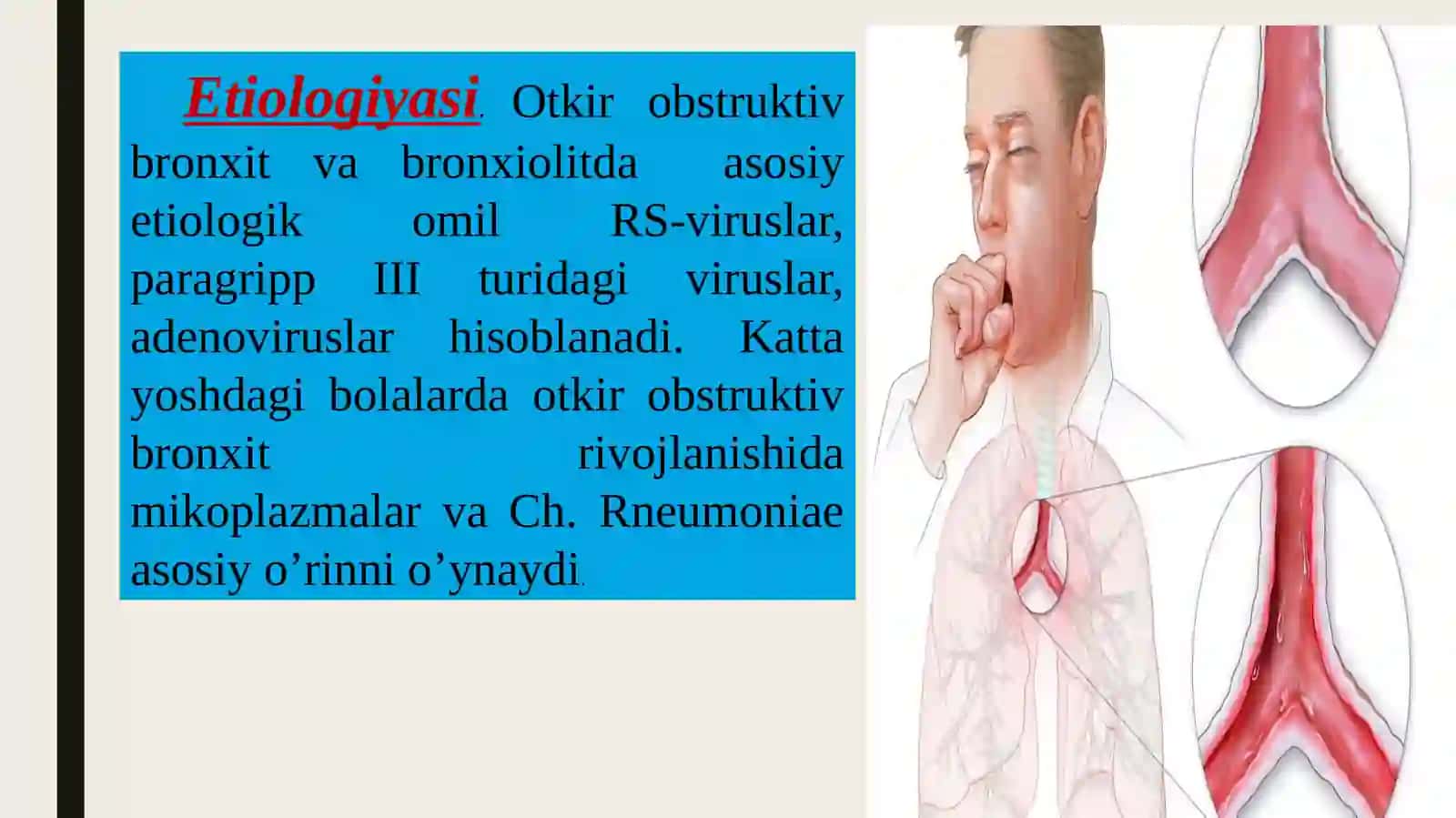 O‘tkir obstruktiv bronxit va bronxiolit 4