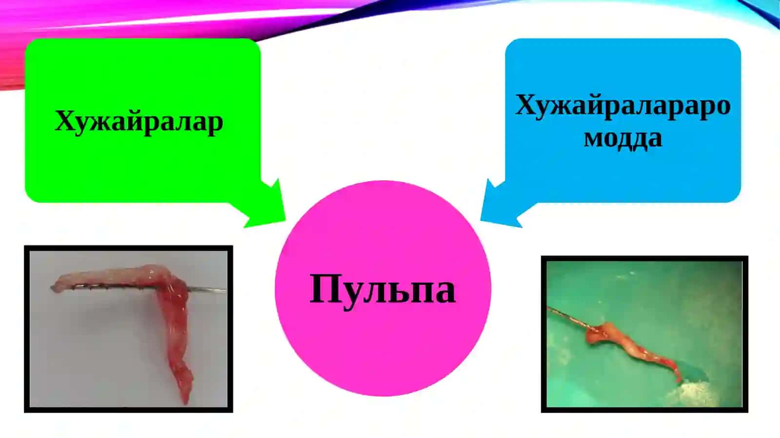 Таснифи. Этиология. Патогенез 4