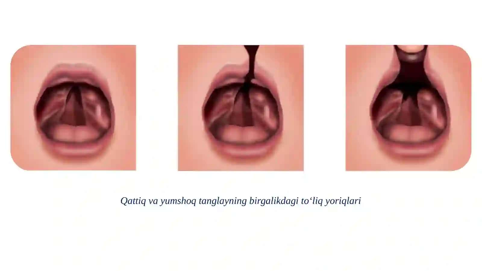 YUQORI JAG‘ VA TANGLAYNING ORTTIRILGAN HAMDA TUG‘MA DEFEKTLARINI ORTOPEDIK DAVOLASH 4