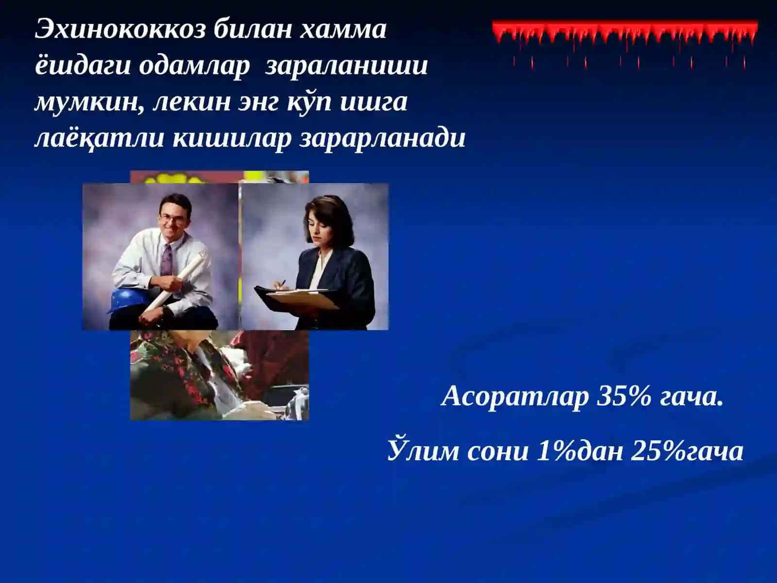 Bolalarda Exinokokk kasalligi. Etiopatogenez,klinika, diagnostika va davolash usullari 4