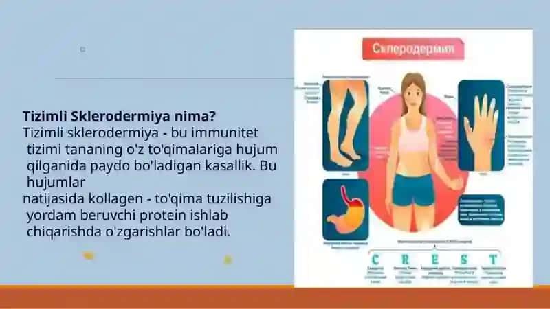 Tizimlisklerodermiya 4