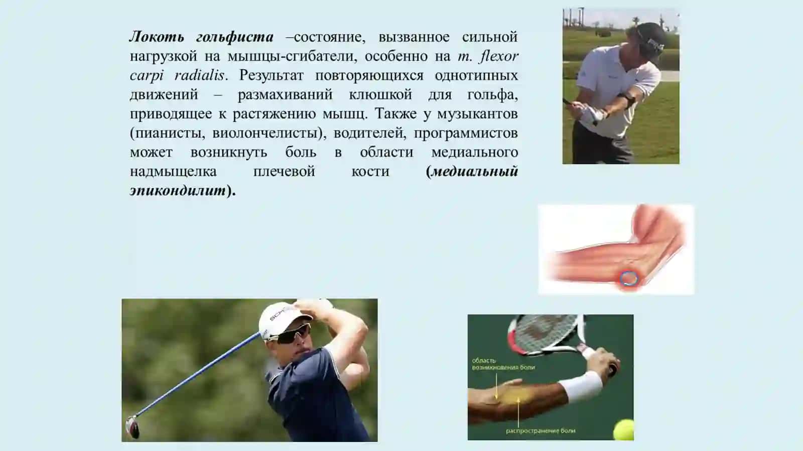 Мышцы предплечья 4