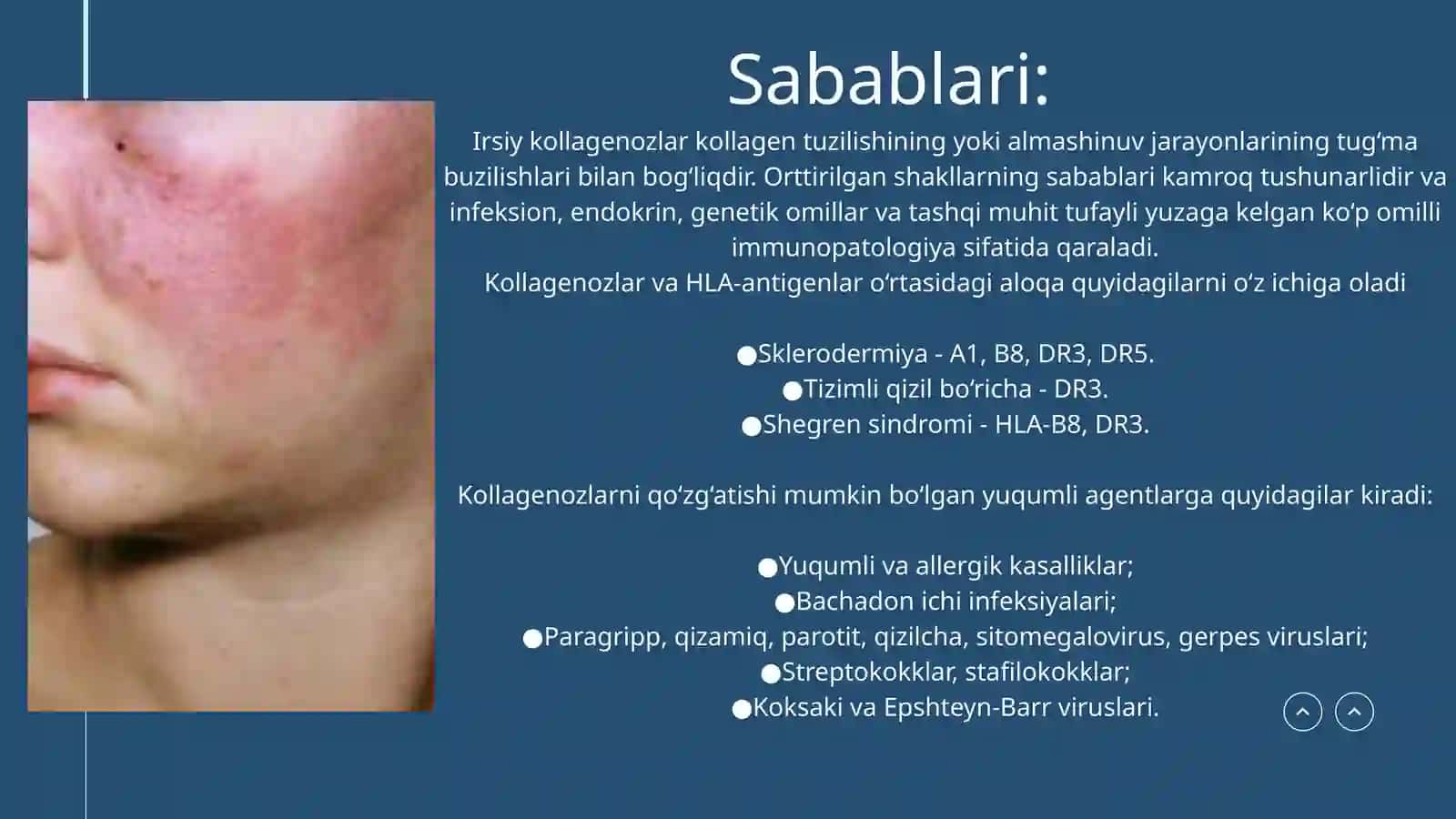 Kollagenozlar 4