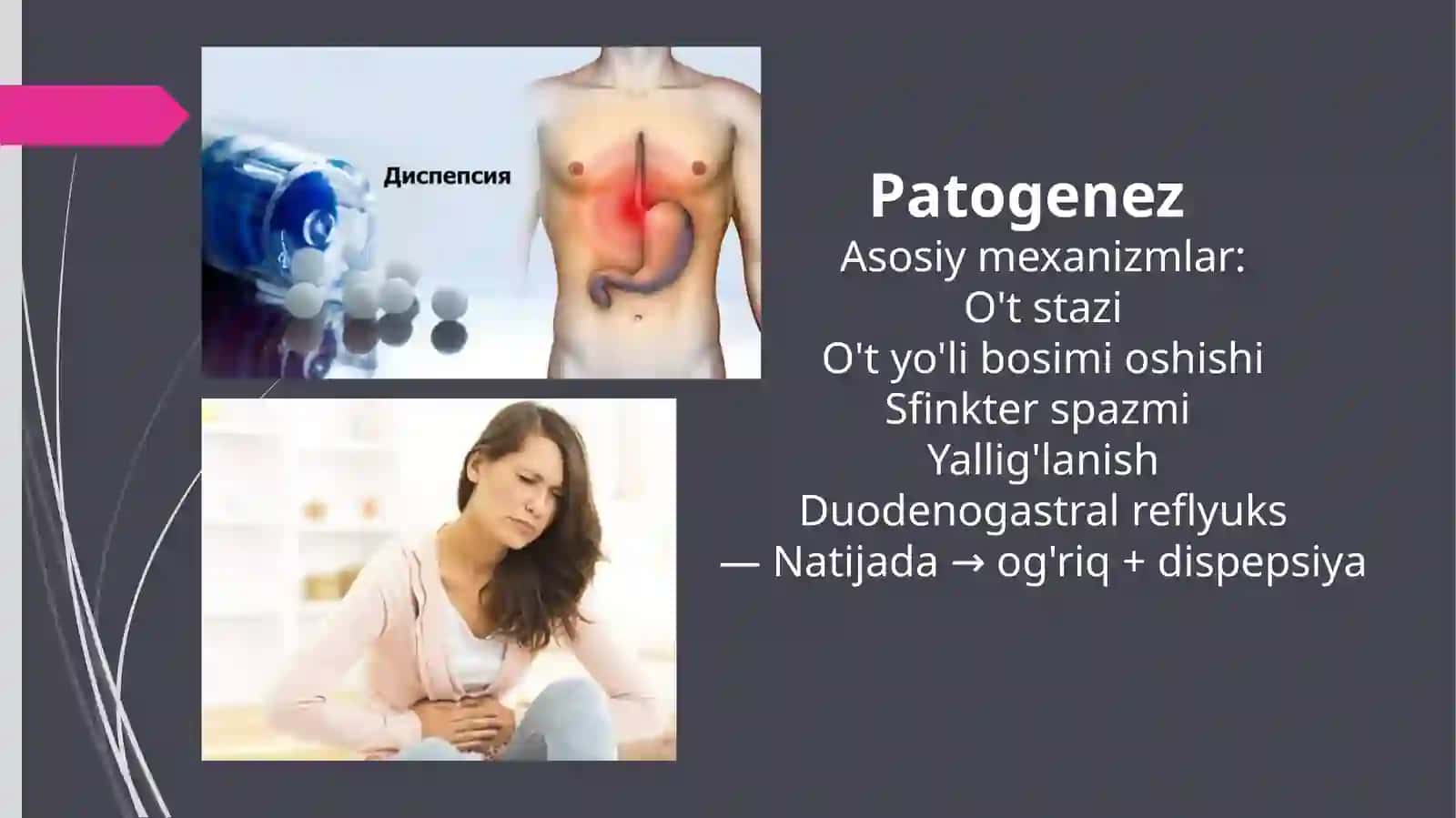Postxolesistektomik sindromlar 4