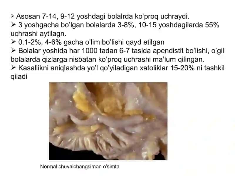3 yoshgacha bo’lgan bolalarda O`tkir appenditsit 4