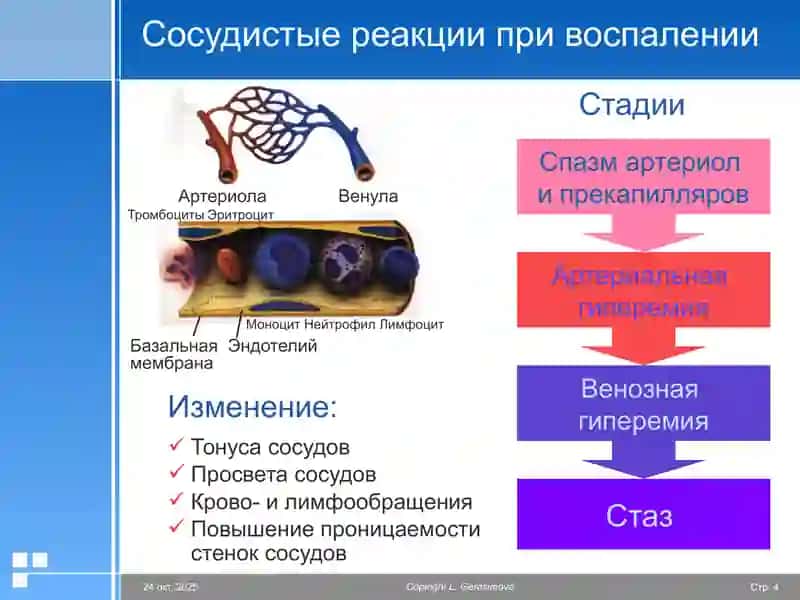 Патофизиология Воспаление 4