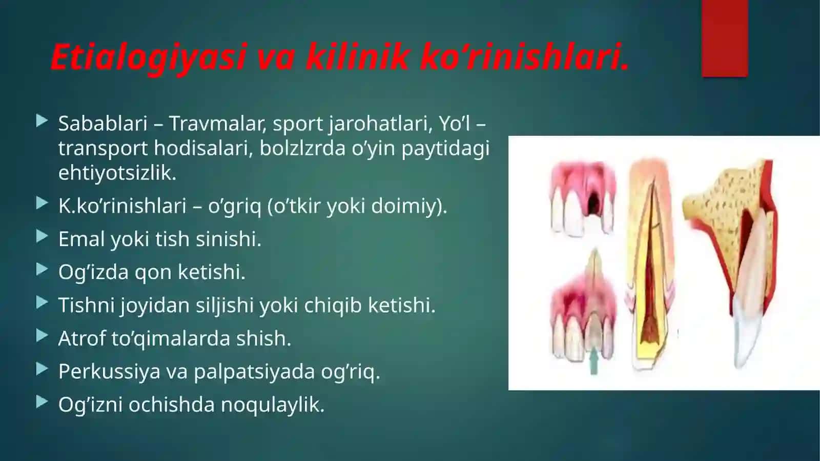 tish jarohati kilinkasi tashxislash davolash 4