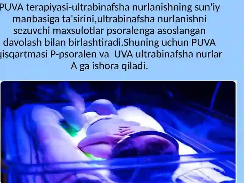 PUVA terapiyasi 4