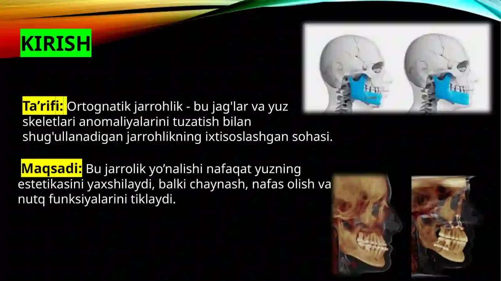 Ortognatik jarrohlik asoslari 4