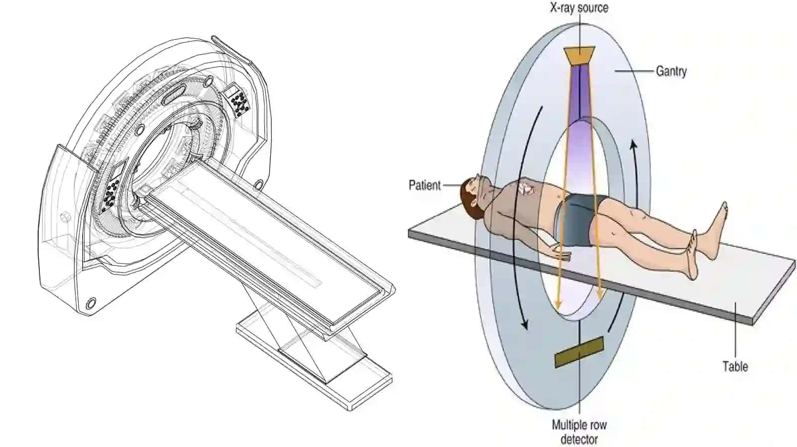 Kompyutertomografiya(KT)ningfizikasoslarivaishlashprinsipi 4