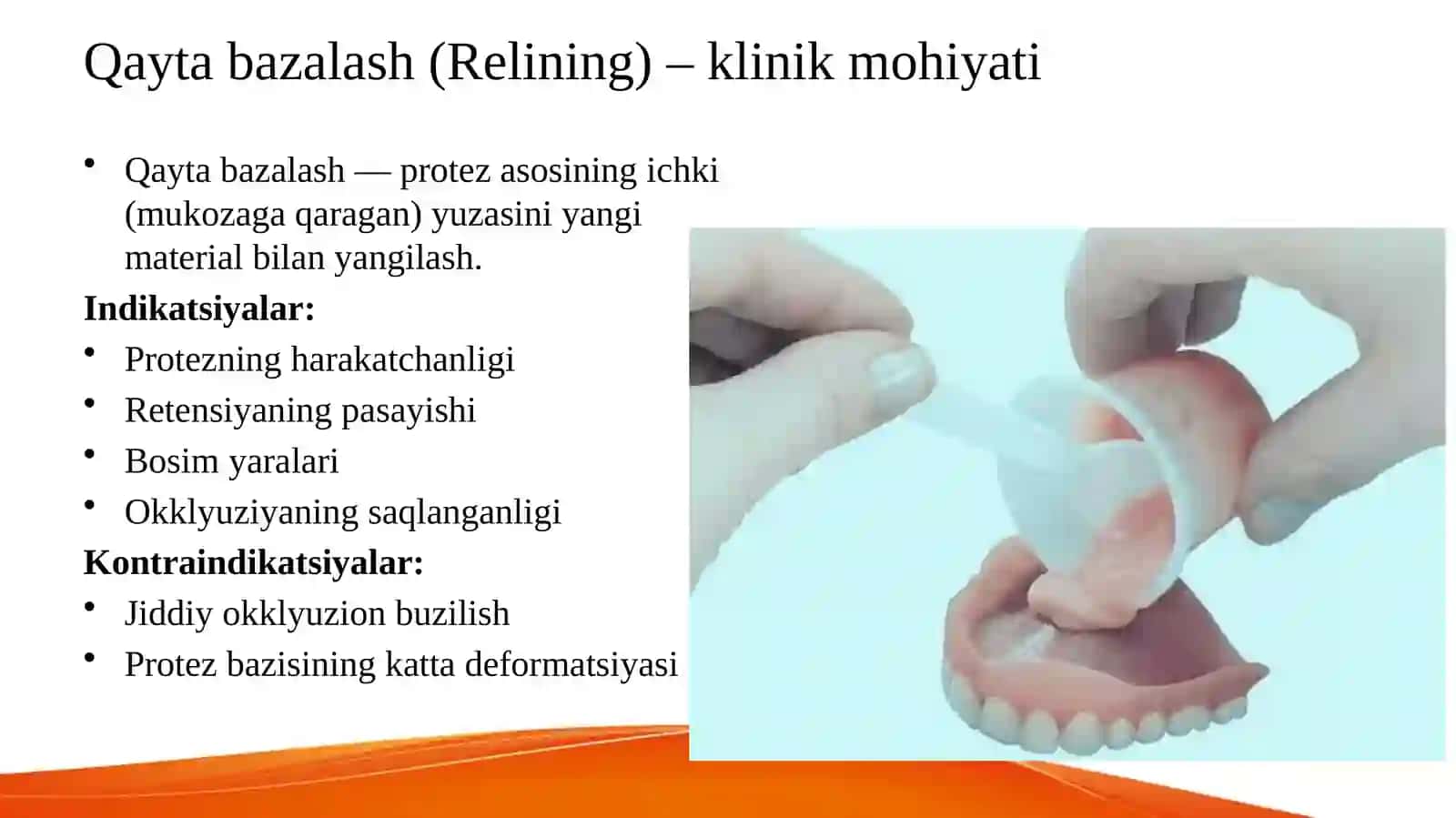 Tish shifokori tomonidan to’liq olinadigan tish protezlari ishlash muddatini uzaytirish usullarining 4