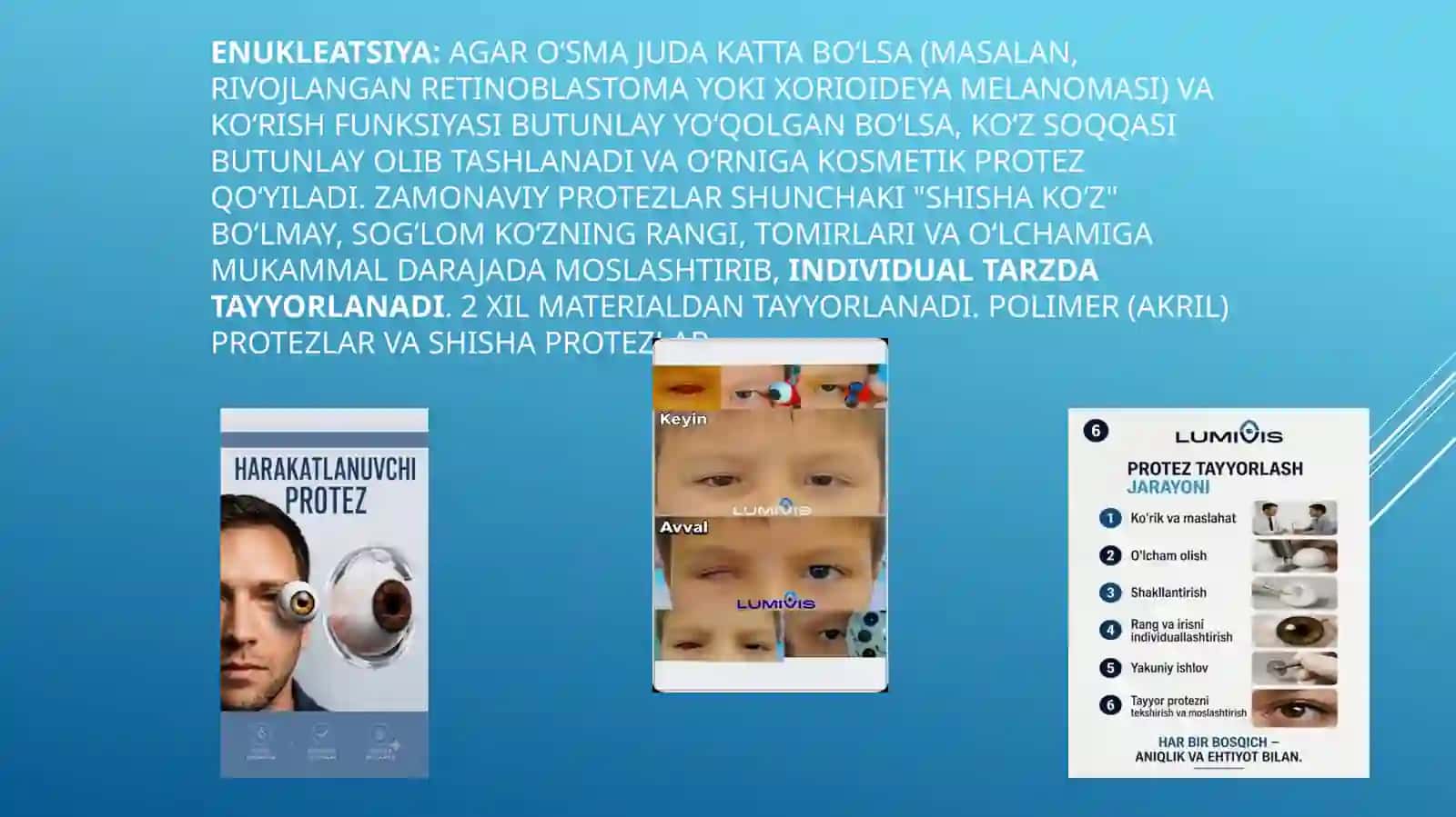 Koʻruv a'zolari davolash taktikasi 4