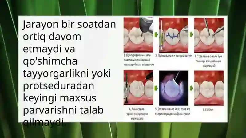 Fissur germatiklar 4