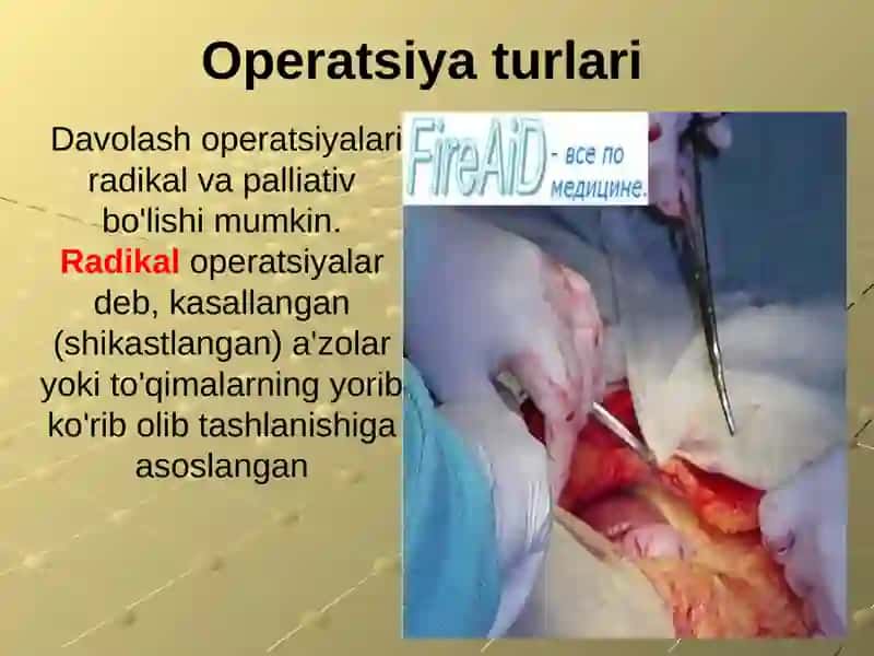 Xirurgik operatsiya va uning, turlari. Operatsiya oldi va operatsiyadan keyingi davrlar 4