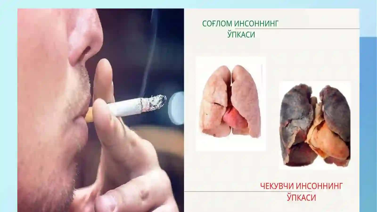Tamakidagi benz(a)pirenni o‘pkada neoplastik  jarayonlar rivojlanishdagi ahamiyativ 4
