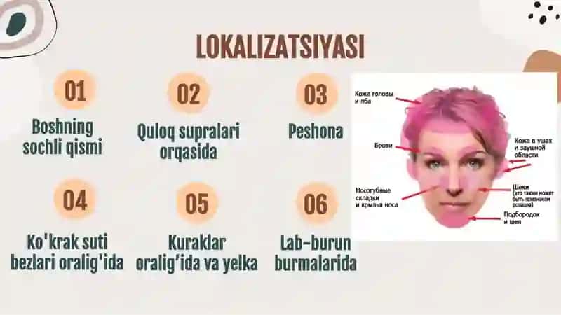 Seboreyali dermatit 4