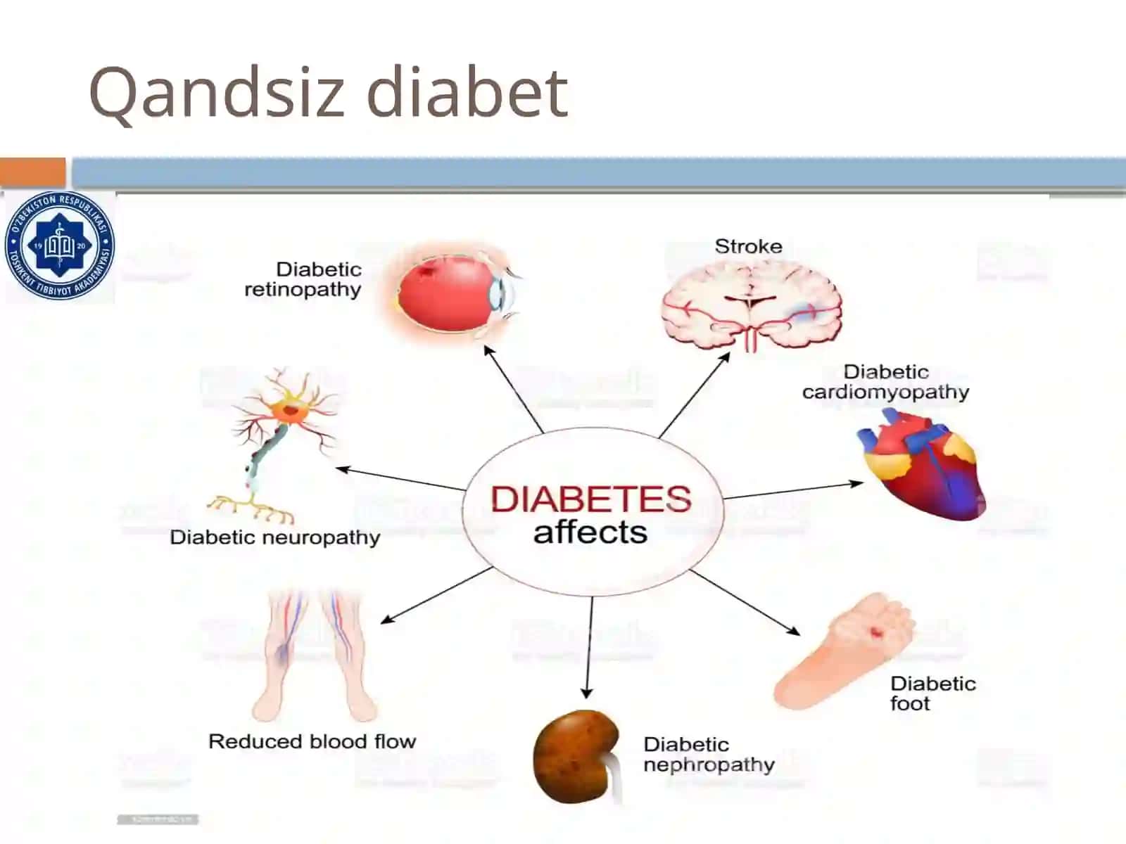 Qandsiz diabet 4