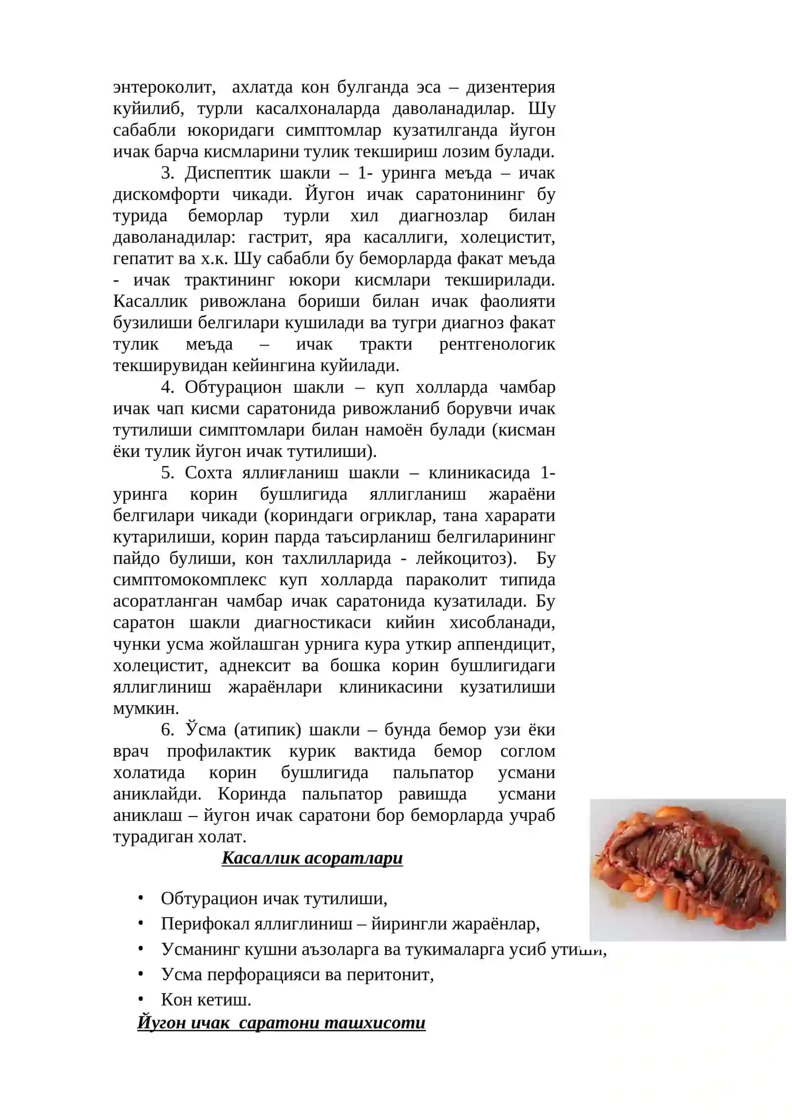 ЙУГОН ИЧАК САРАТОНИ 4