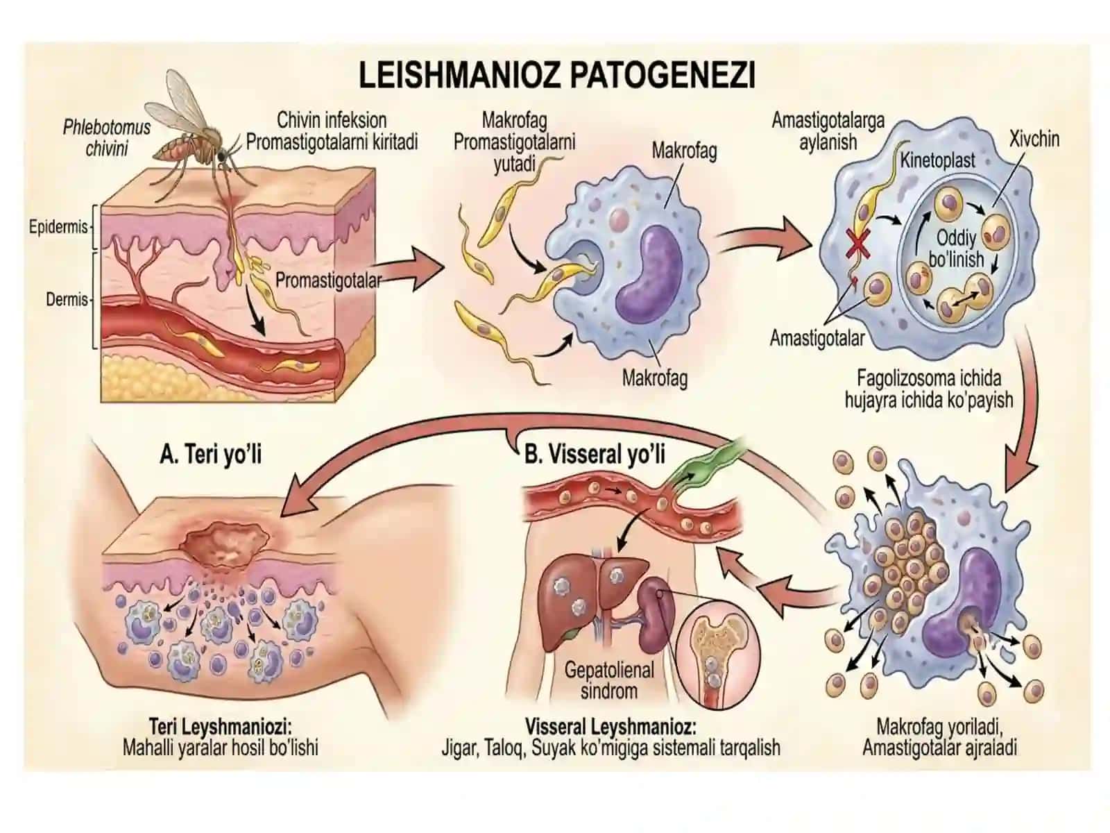 Leyshmanyoz 4