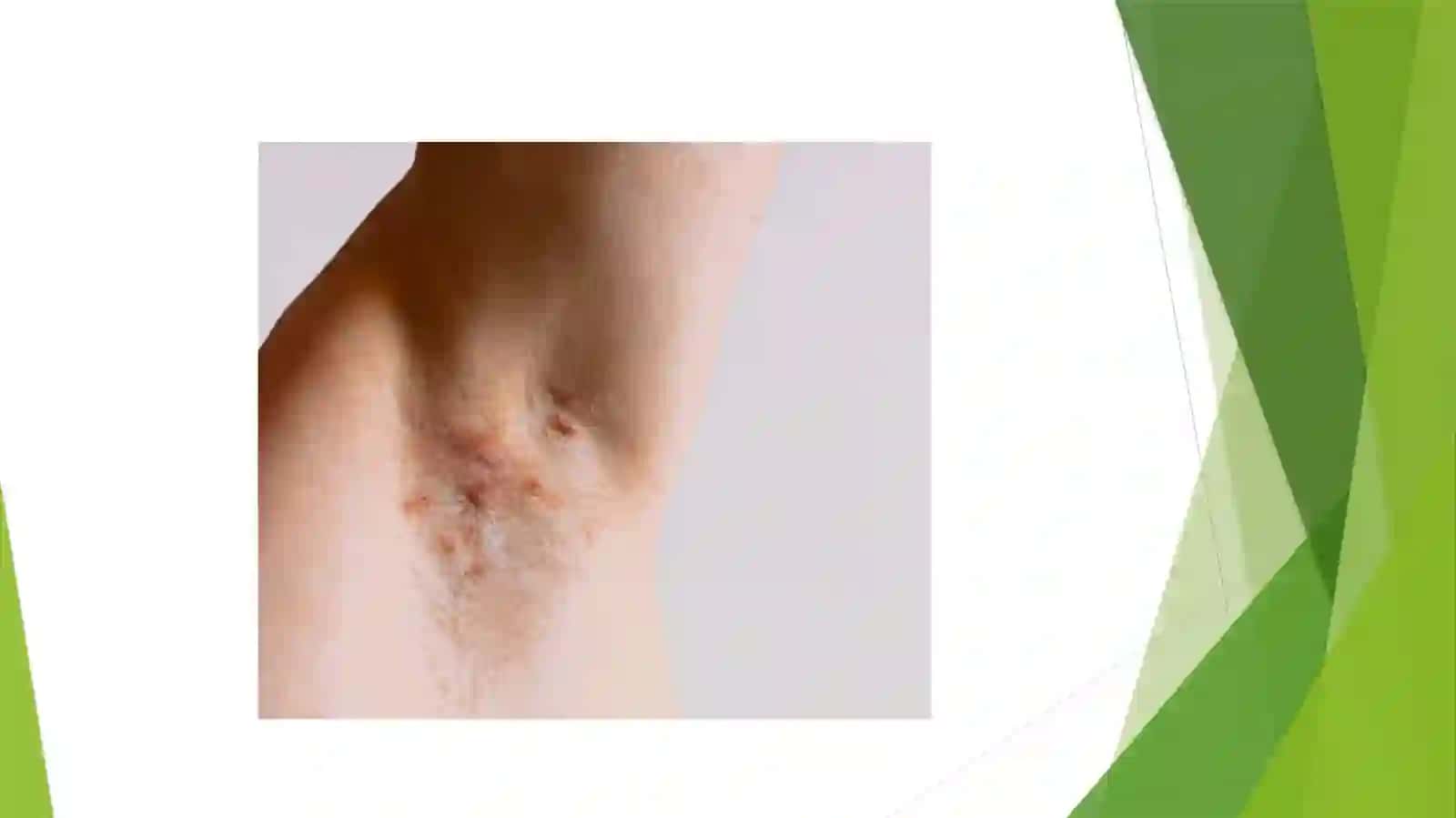 Umumiy Xirurgiya Fanidan Tayyorlagan Mustaqil Ishi 4
