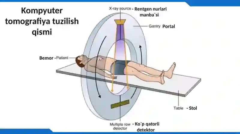 Kompyuter tomografiyasi 4