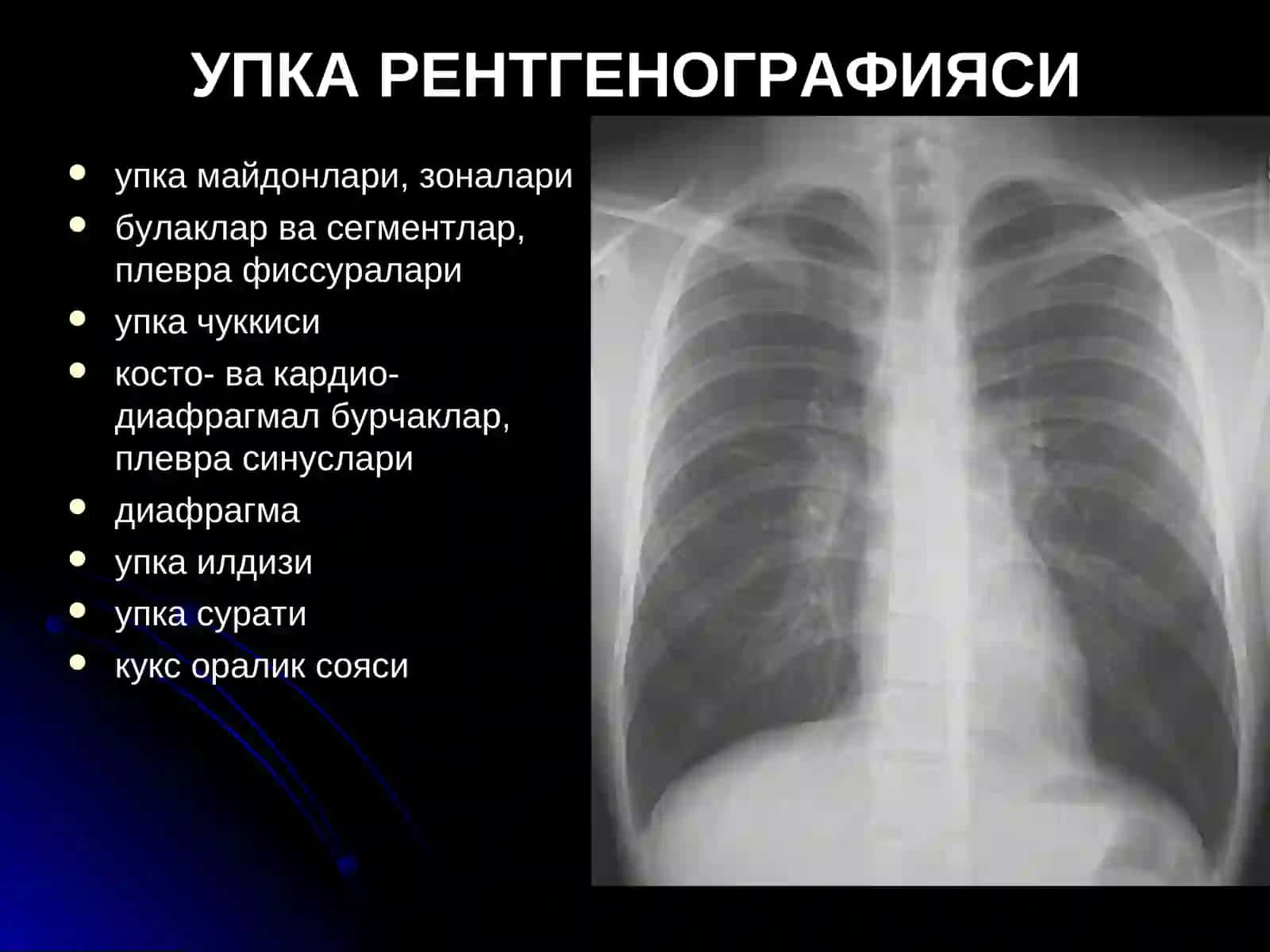 Упка касалликларининг нур ташхиси 4