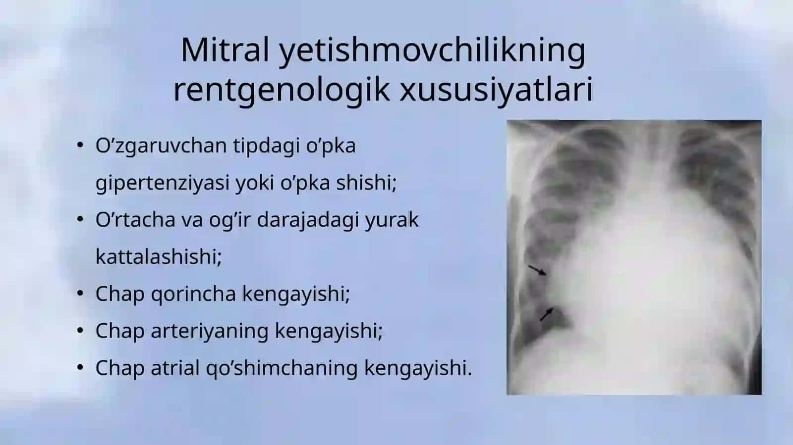 Mirtal qopqoqcha yetishmovchiligi 4