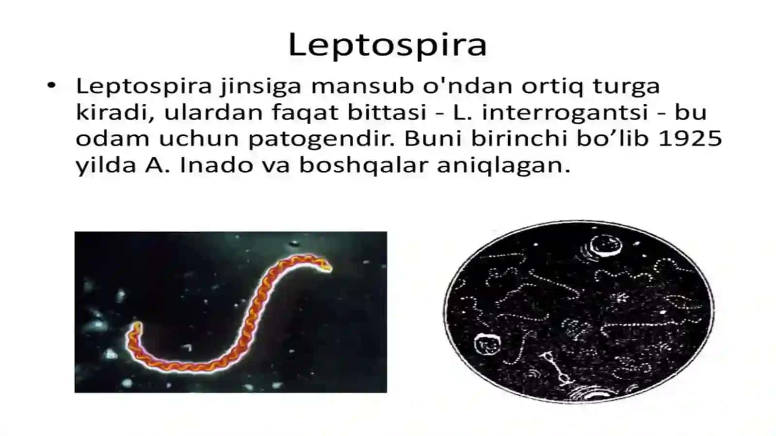 LEPTOSPIROZLARMORFOLOGIYASI,STRUKTURASI,TARQALGANLIGINI KELTIRIB CHIQARUVCHI KASALLIKLAR LABARATORIYA DIAGNOSTIKASI 4