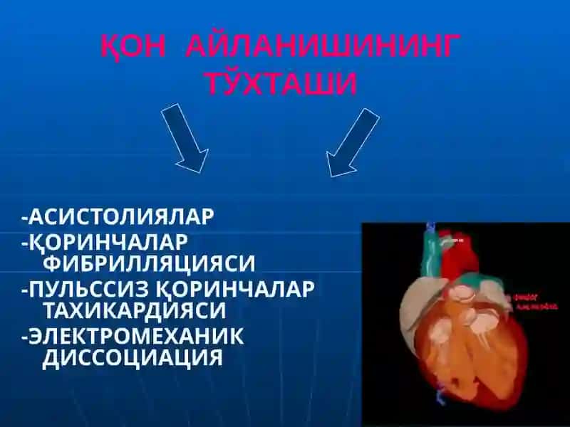 ЮРАК- ЎПКА  РЕАНИМАЦИЯСИНИ ЎТКАЗИШ 4