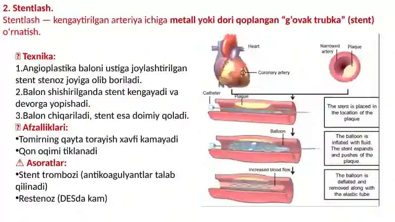 Endovaskulyar operatsiyalar. O‘mrov osti va son venalarini punksiyaqilish va kateterlash. Mikroxirurgik texnika. Transplantologiyadamikroxirurgiyaning qo‘llanilishi. 4