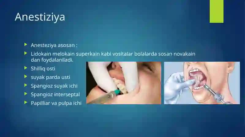 Surunkali chuqur kariesni davolash usuli 4