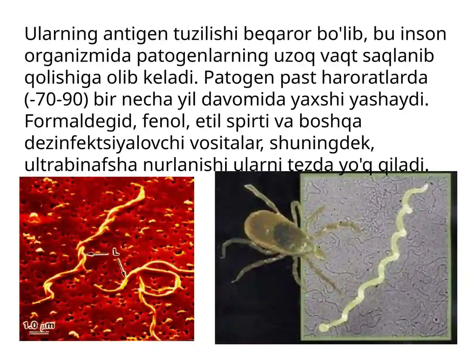 Borrelioz (Laymkasalligi) 4