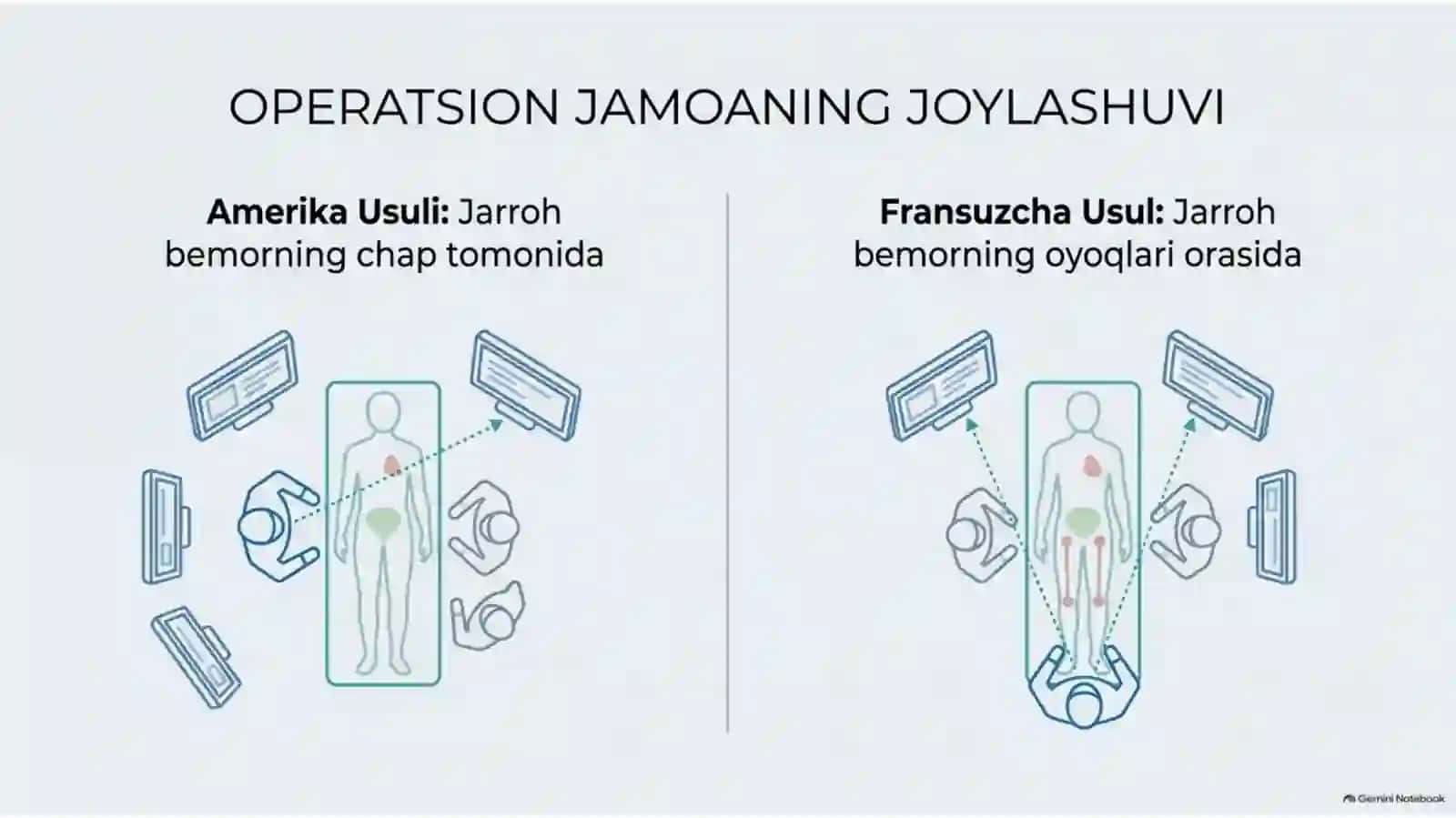 Laparoskopik xoletsistektomiya: texnika va xavfsizlik | 15 slayd 4
