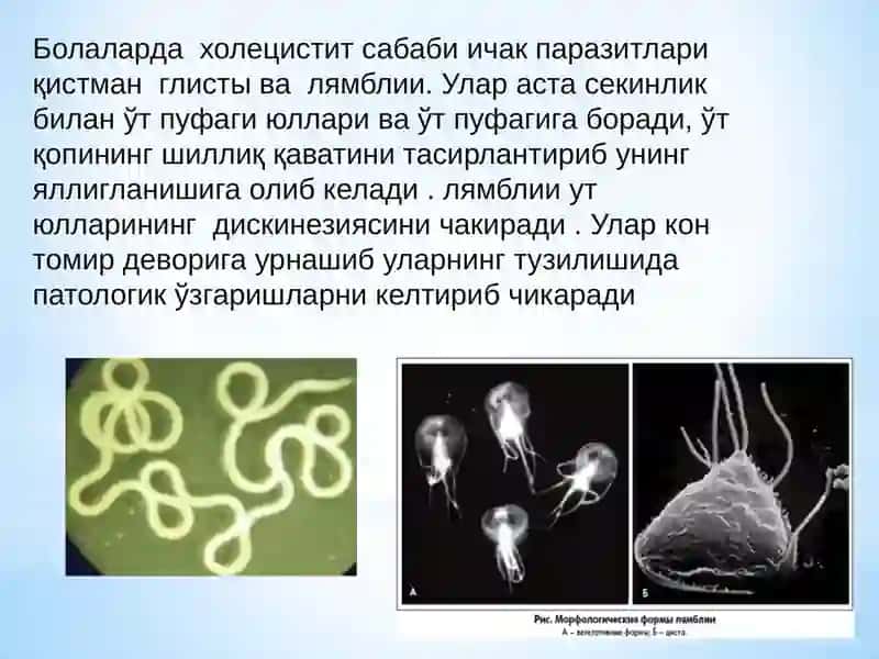 Xolisistit. Sabablari, etiologiyasi va davolash 4