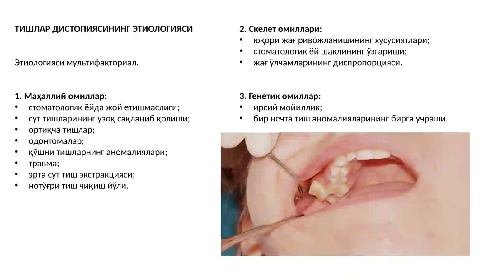 Тишлар жойлашиши ва чиқиши аномалиялари 4