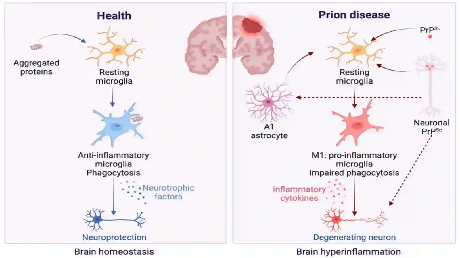 Prion Kasalliklari 4