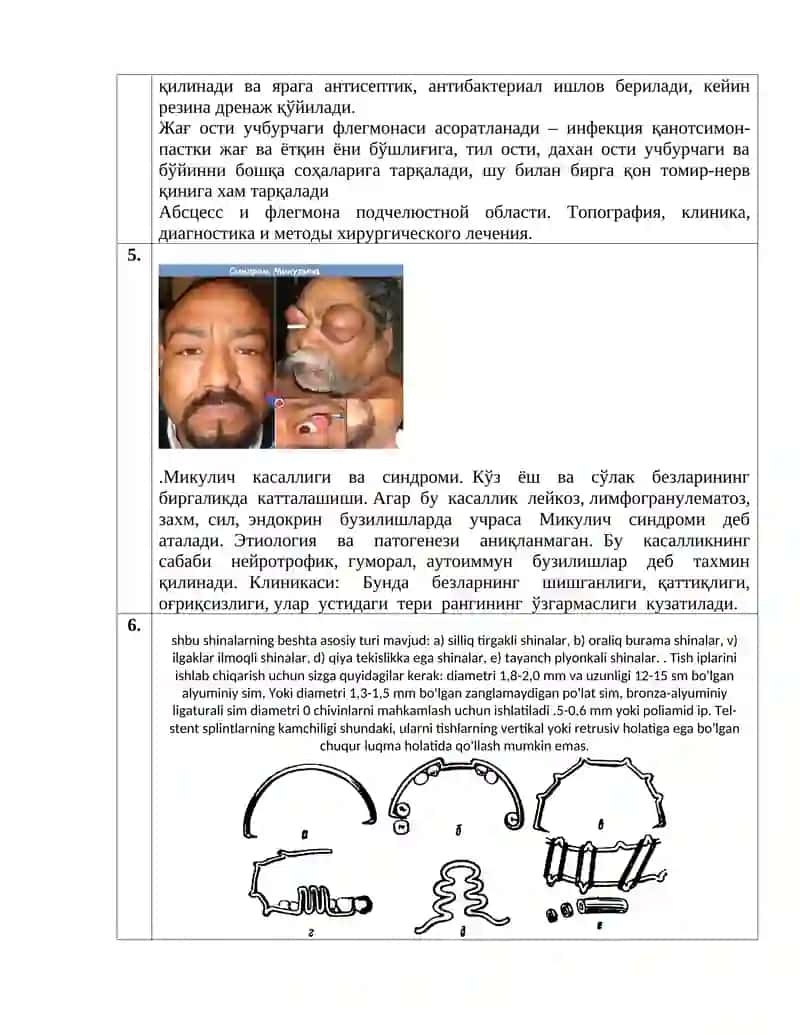 Сўлак безларини ўткир ва сурункали номахсус яллиғланиш касалликлари 4