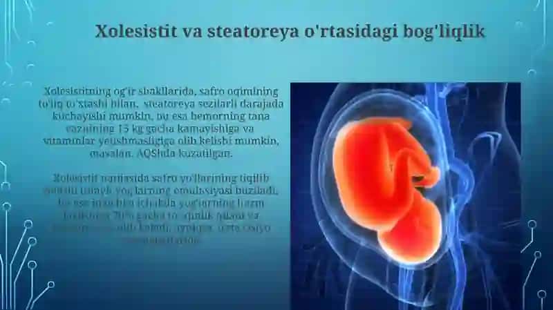 Steatoreya: ta'rifi va klinik ko'rinishlari 4
