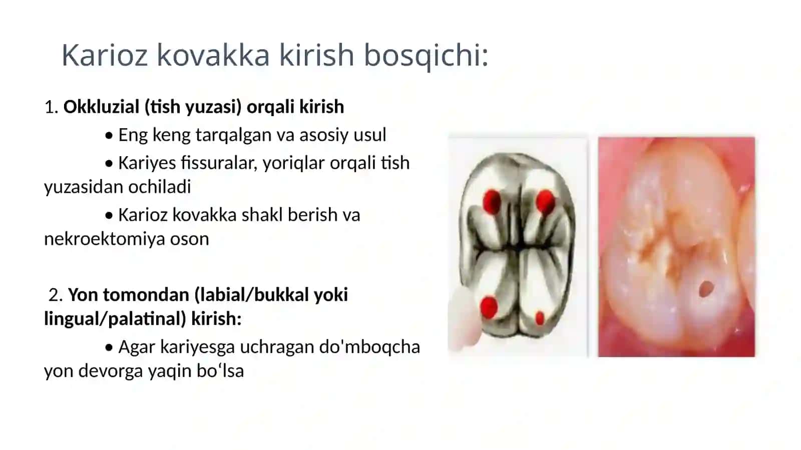 Fantomlarda 6-sinf karioz bo'shliqlarini charxlash va plombalash 4