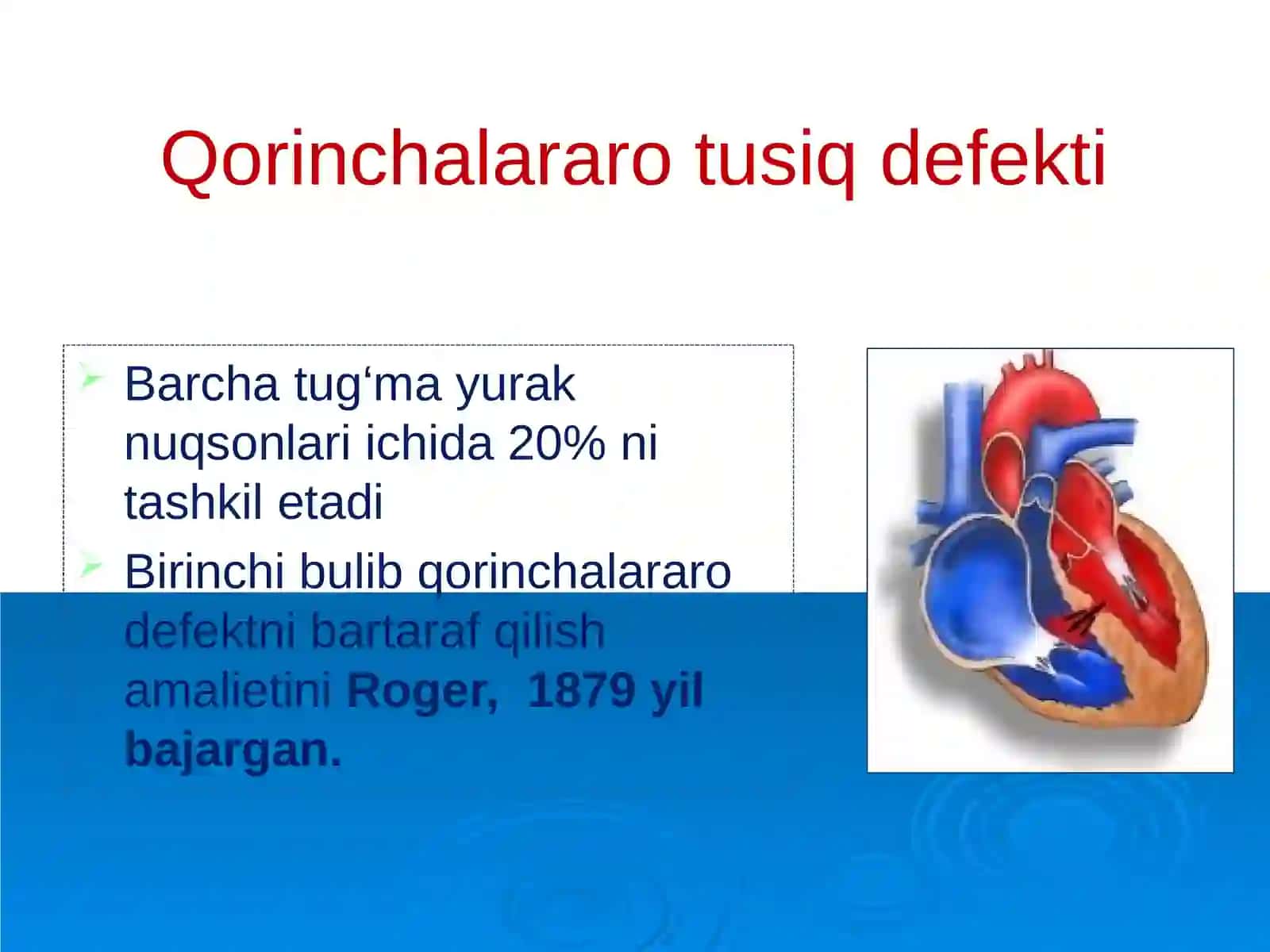 Tug‘ma yurak nuqsonlari 4