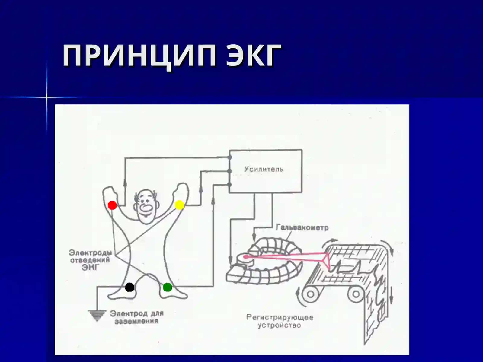 Э К Г 4