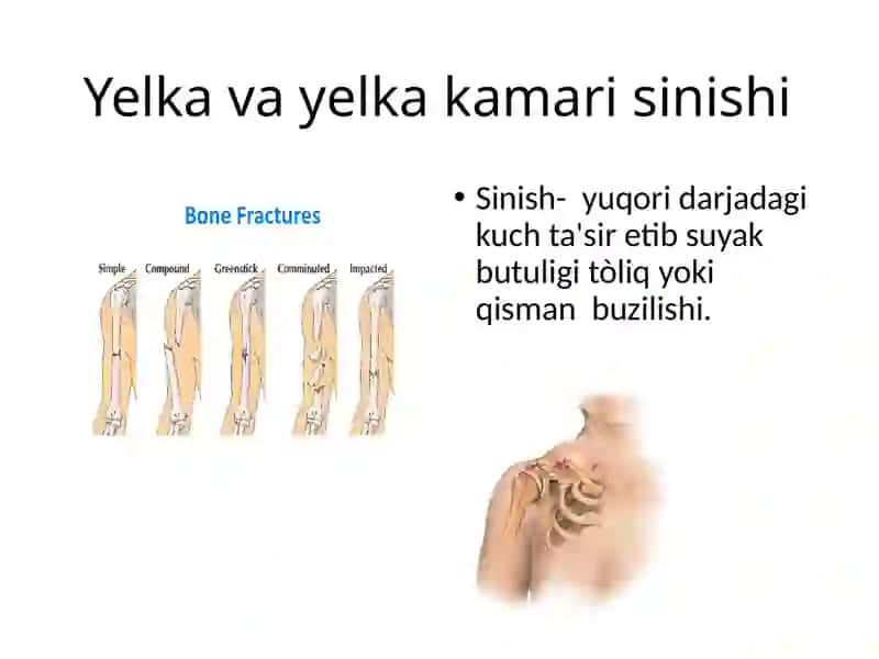 Yelka va yelka kamari. Tasnifi. Klinik òziga xosligi, shikastlanish mexanizmi, immobilizatsiya va davolash asoratlari 4