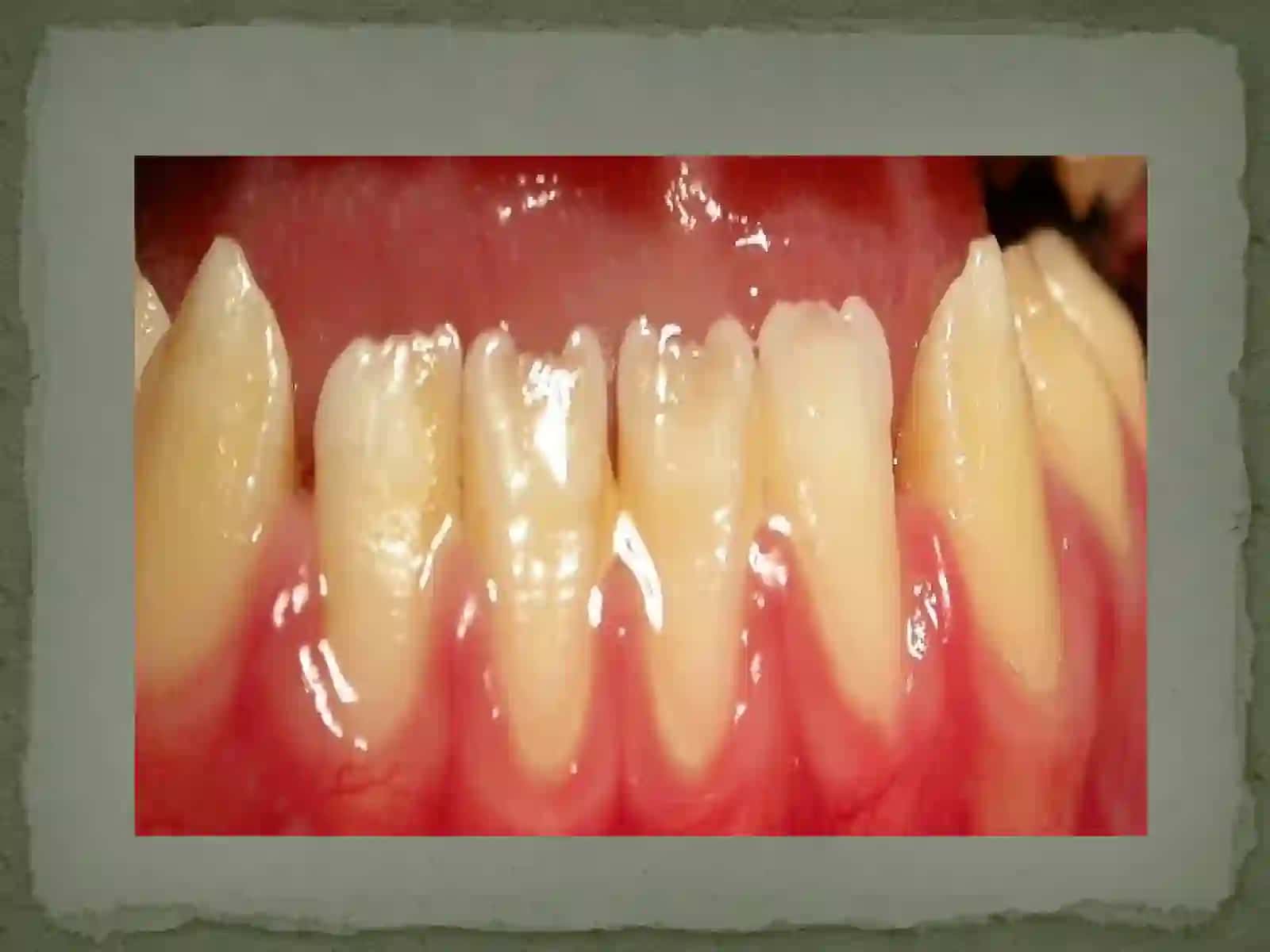 TUGALLANMAGAN AMILOGENEZ VA DENTINOGENEZ 4