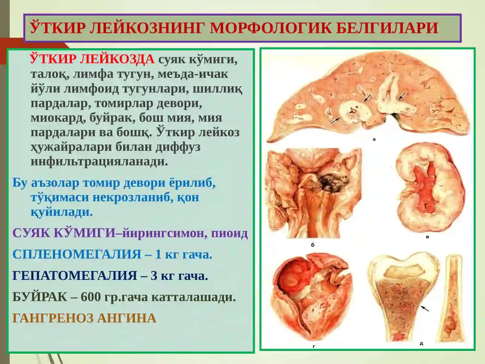Гемопоэз 4