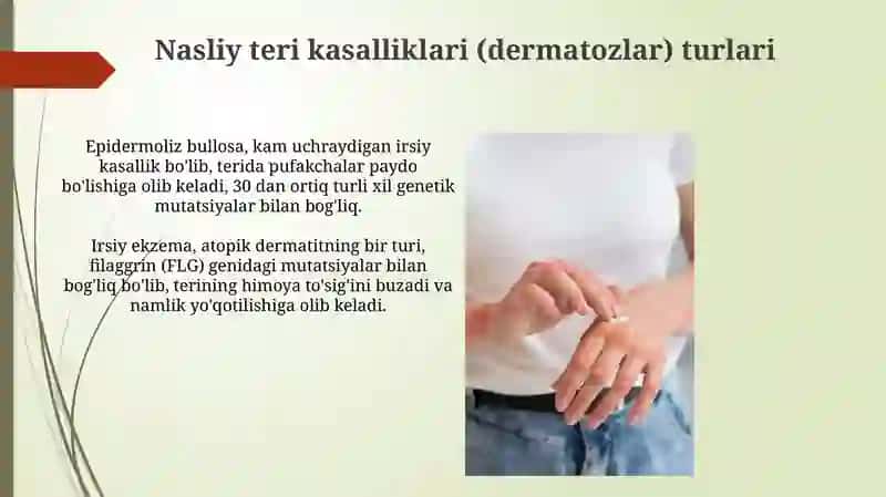 Terining (dermatozlar) nasliy kasalliklari, qandsiz diabet kasalligi 4