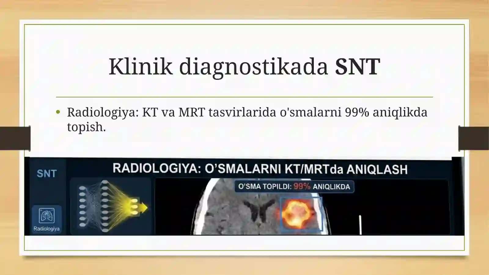 TIBBIYOTDA SUN’IY NEYRON TARMOQLARNI QO‘LLASH VA ULARNING ISTIQBOLLARI 4