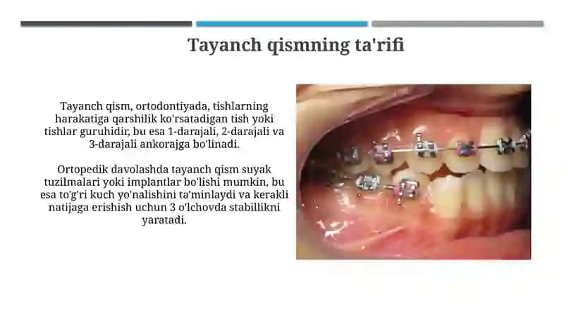 Tayanch qism tasnifi va ortodontik davolash 4