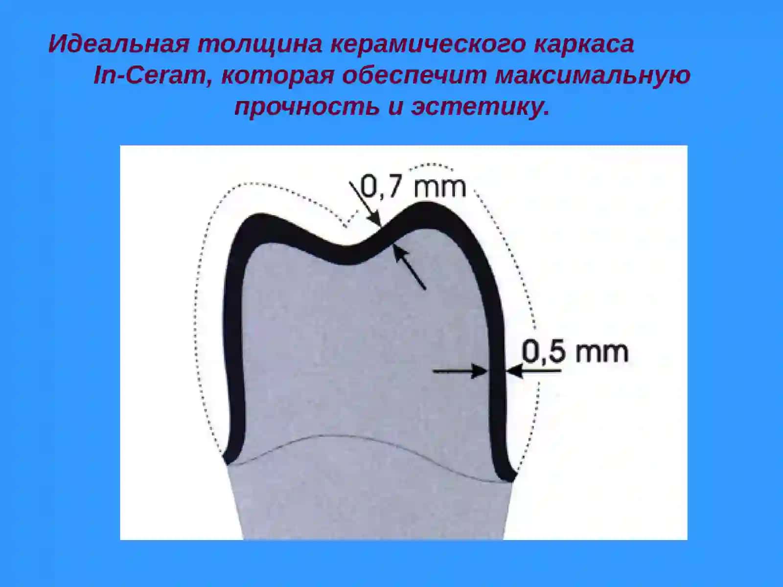 CAD/CAM технологииCerecinLab 4