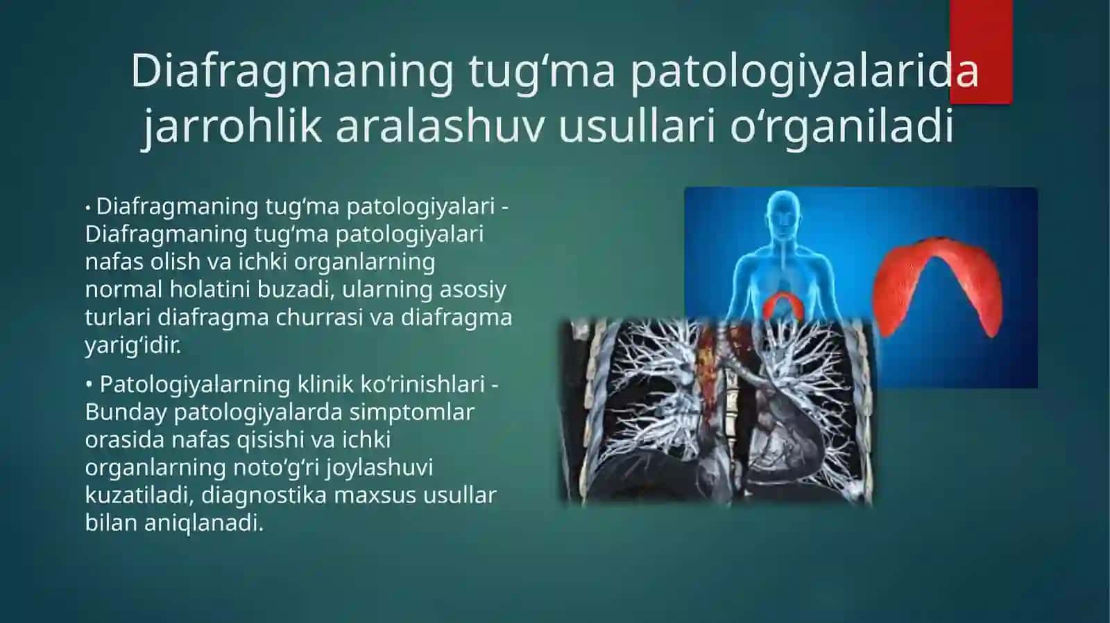 Ko‘krak devori tug‘ma va orttirilgan nuqsonlarida operatsiyalar 4
